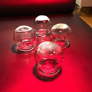 glass cupping therapy jars