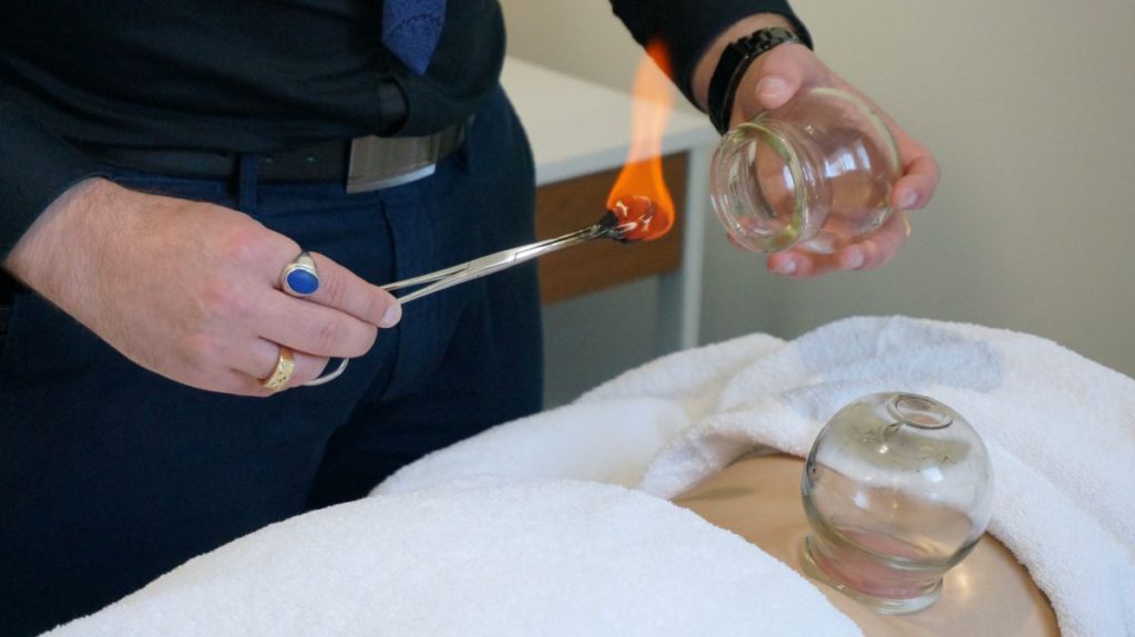 Cupping Therapy Benefits: Explore Healing in Melbourne