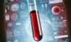 Vitamin B12 Blood Test: A Guide for Bridlington Residents