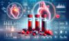 Cholesterol Blood Test Guide: Key Health Insights for Milton Keynes