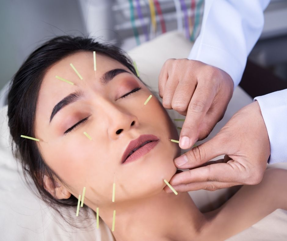 Cosmetic Acupuncture: Important Drawbacks You Should Know